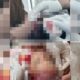 Suami di Konawe Membabi Buta Aniaya Istri, Kepala Anak 2 Tahun Jadi Korban Tebasan Parang. Foto: Istimewa.
